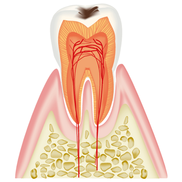 C1